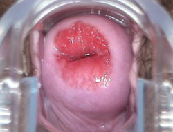 ��ȡ��жȡ��ضȹ�������֢״��ͼƬ