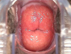 ��ȡ��жȡ��ضȹ�������֢״��ͼƬ