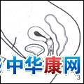 Protectaid@������