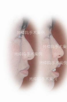�ǲ����� 