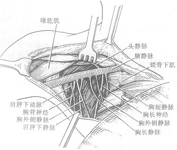 乳癌根治术_普通外科学